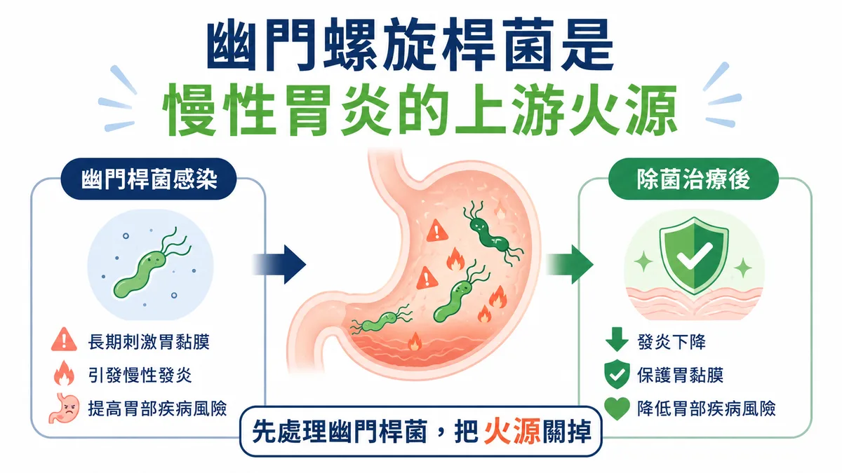 幽門螺旋桿菌是胃黏膜長期發炎的點火源：除菌等於把火源關掉，讓慢性胃炎、萎縮與腸化生不再繼續惡化
