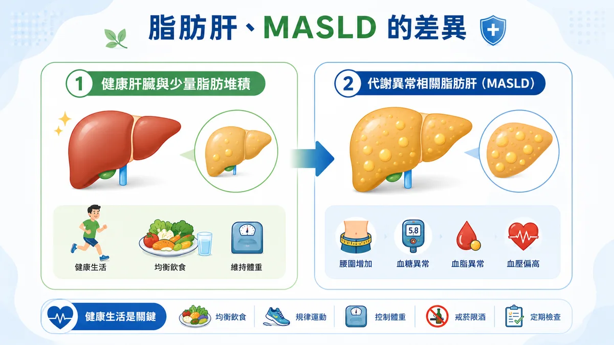 圖解脂肪肝、MASLD 與 MASH 的差別：從單純脂肪堆積到肝臟開始發炎、受傷