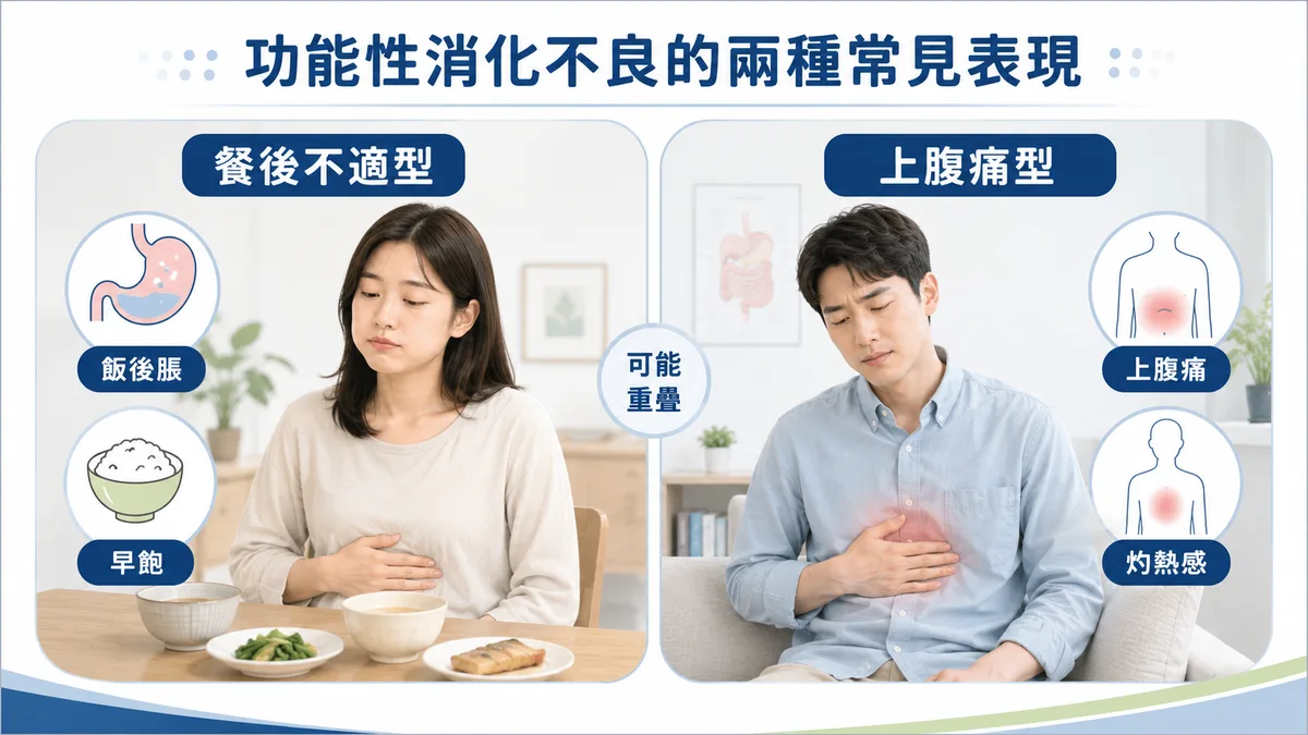 功能性消化不良兩種亞型示意圖：餐後不適型（PDS）以飯後脹悶與早飽為主；上腹痛型（EPS）以上腹痛或灼熱感為主，兩者可重疊