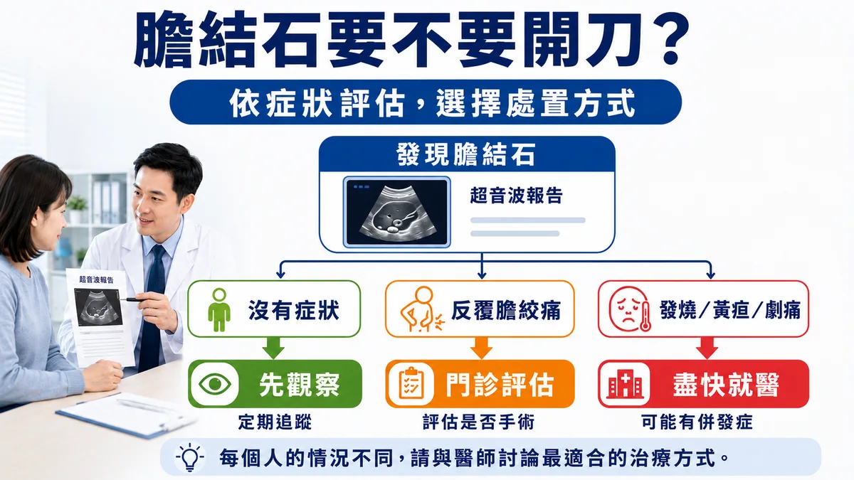 膽結石要不要開刀決策圖：沒有症狀先觀察追蹤、反覆膽絞痛門診評估、發燒黃疸劇痛盡快就醫
