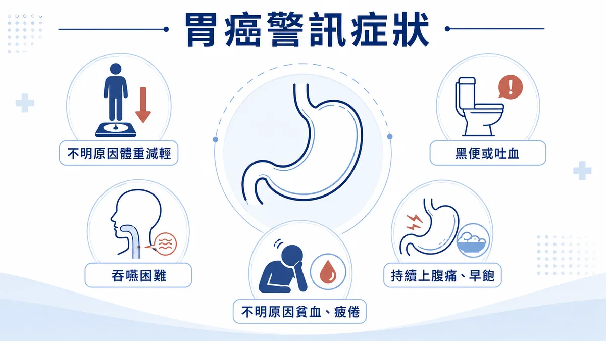 胃癌警訊症狀整理：不明原因體重減輕、黑便或吐血、吞嚥困難、持續上腹痛、持續嘔吐、不明原因貧血