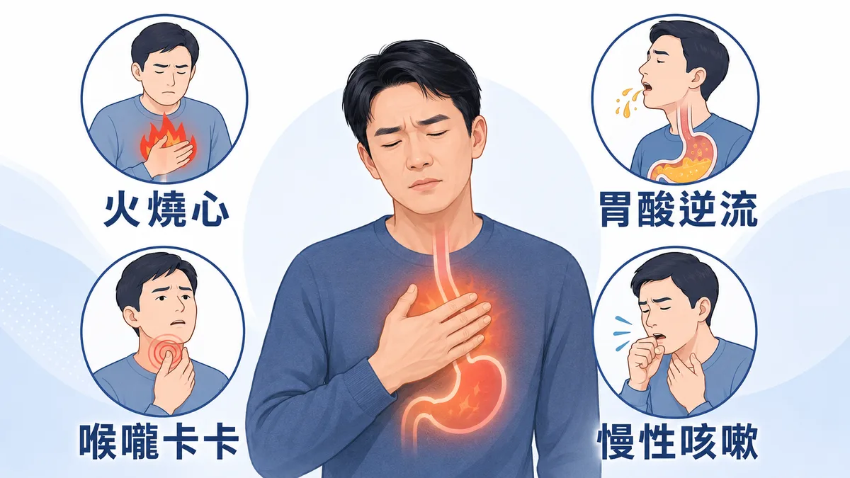 胃食道逆流常見症狀：火燒心、胃酸逆流、喉嚨卡卡、慢性咳嗽