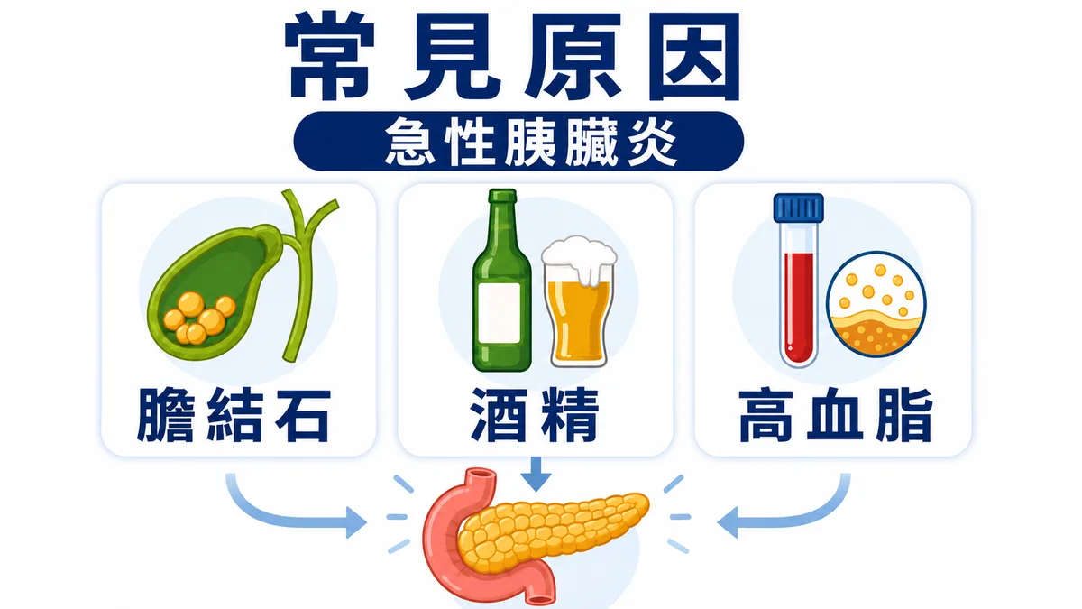 急性胰臟炎常見原因圖：膽結石、酒精與高血脂都可能引發胰臟發炎