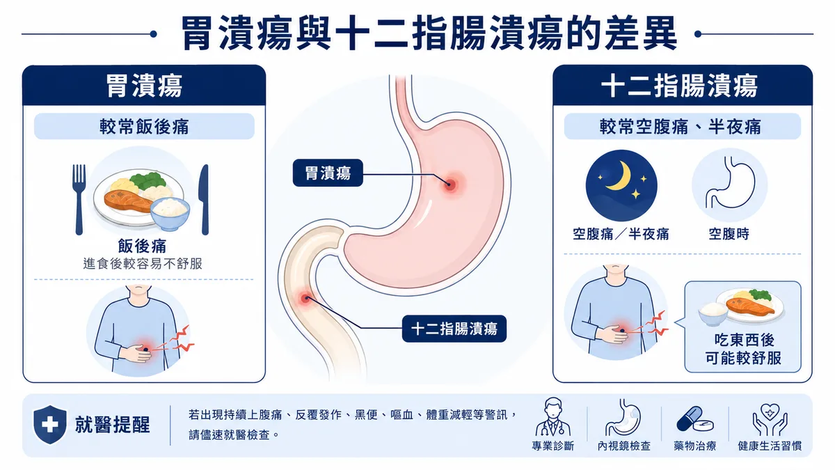 胃潰瘍 vs 十二指腸潰瘍對照：位置、疼痛時機（飯後痛 vs 空腹/半夜痛）、與胃癌關係與追蹤建議