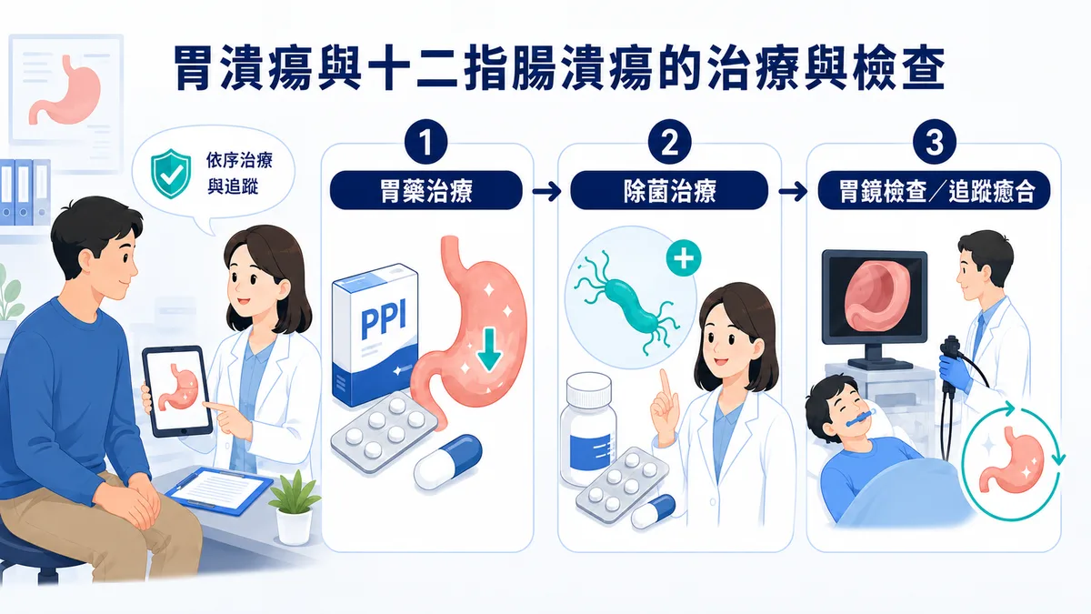 消化性潰瘍治療與胃鏡角色：PPI 降胃酸 4–8 週、幽門桿菌除菌、調整止痛藥，以及切片與追蹤胃鏡